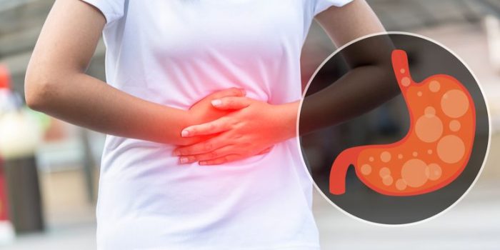 Cara Mengatasi Asam Lambung Secara Efektif
